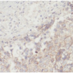 Fibroblast Growth Factor 8 (FGF8) Antibody