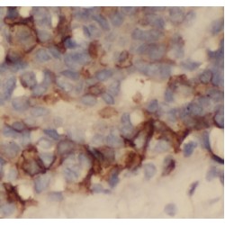Fibroblast Growth Factor Receptor 1 (FGFR1) Antibody