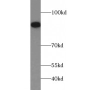 WB analysis of K-562 cells, using FGFR1 antibody (1/1000 dilution).