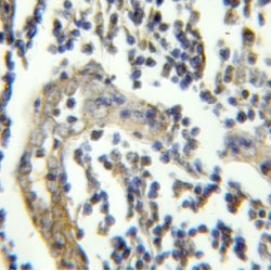 FGFR1 Oncogene Partner (FGFR1OP) Antibody
