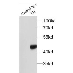 Fumarate Hydratase (FH) Antibody