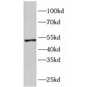 WB analysis of HeLa cells, using FH antibody (1/1000 dilution).