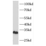 WB analysis of human brain tissue, using FHL1 antibody (1/1000 dilution).