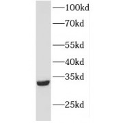 WB analysis of mouse ovary tissue, using FHL2 antibody (1/1000 dilution).