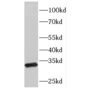 WB analysis of mouse heart tissue, using FHL5 antibody (1/2000 dilution).