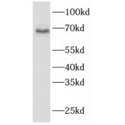 WB analysis of mouse heart tissue, using FBLN5 antibody (1/400 dilution).