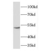 WB analysis of A549 cells, using FICD antibody (1/600 dilution).