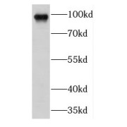 WB analysis of HepG2 cells, using Filensin antibody (1/500 dilution).