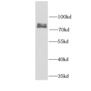 WB analysis of K-562 cells, using FIP1L1 antibody (1/1000 dilution).