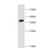 WB analysis of human testis tissue, using FKBP6 antibody (1/1000 dilution).