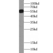 WB analysis of Flagged fusion protein, using Flag tag antibody (1/1000 dilution).