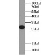 WB analysis of Flagged fusion protein, using Flag tag antibody (1/5000 dilution).
