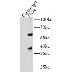 Folliculin (FLCN) Antibody