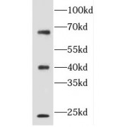 WB analysis of mouse thymus tissue, using FLCN antibody (1/300 dilution).