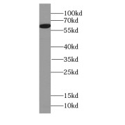 WB analysis of PC3 cells, using FMO5 antibody (1/600 dilution).