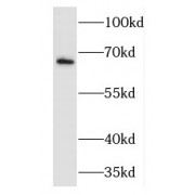 WB analysis of MCF7 cells, using FMR1NB antibody (1/1000 dilution).