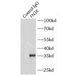 Fructosamine-3-Kinase (FN3K) Antibody