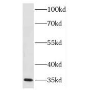 WB analysis of HeLa cells, using FN3K antibody (1/500 dilution).