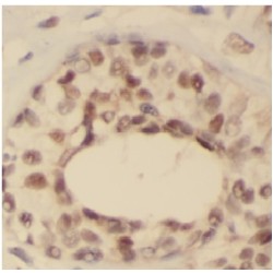 Forkhead Box Protein A1 (FOXA1) Antibody