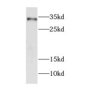 WB analysis of HepG2 cells, using FOXE3 antibody (1/300 dilution).