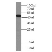 WB analysis of mouse liver tissue, using FOXH1-Specific antibody (1/300 dilution).