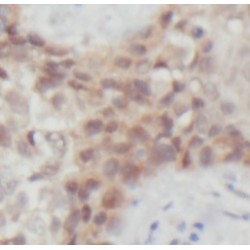Forkhead Box Protein O3 (FOXO3A) Antibody