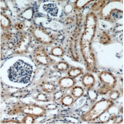 Forkhead Box Protein O4 (FOXO4) Antibody