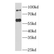 WB analysis of Jurkat cells, using FOXP1 antibody (1/1000 dilution).
