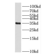 WB analysis of mouse liver tissue, using FOXS1 antibody (1/600 dilution).