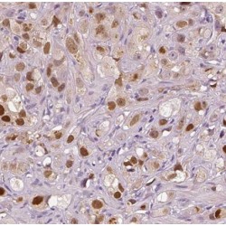 Fascin 3 (FSCN3) Antibody