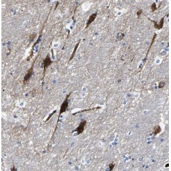 Fibronectin Type III And SPRY Domain Containing 1-Like (FSD1L) Antibody