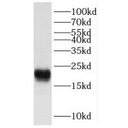 WB analysis of human brain tissue, using FXYD6 antibody (1/400 dilution).