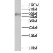 WB analysis of HeLa cells, using FYTTD1 antibody (1/300 dilution).