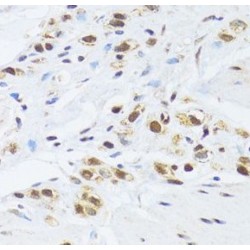 GA Binding Protein Subunit Beta 1 (GABPB1) Antibody