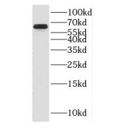WB analysis of mouse skeletal muscle tissue, using GABRA4 antibody (1/500 dilution).