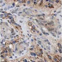 Gamma-Aminobutyric Acid Receptor Subunit Gamma-1 (gABRG1) Antibody