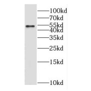 WB analysis of mouse eye tissue, using GABRG1 antibody (1/600 dilution).