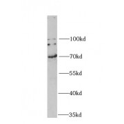 WB analysis of HeLa cells, using GAD2 antibody (1/1000 dilution).