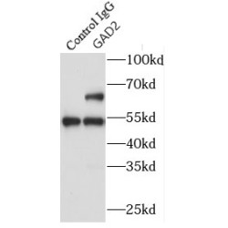 Glutamate Decarboxylase 2 (GAD2) Antibody