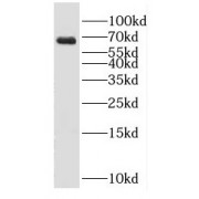 WB analysis of mouse brain tissue, using GAD2 antibody (1/1000 dilution).