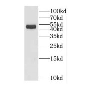 WB analysis of Mouse cerebellum tissue, using GADL1 antibody (1/300 dilution).