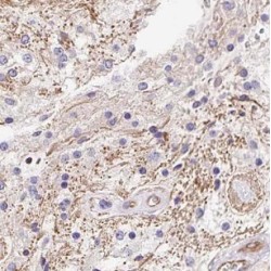 Galactosylceramidase (GALC) Antibody