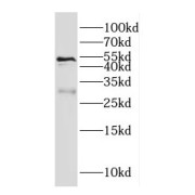WB analysis of mouse brain tissue, using Galc antibody (1/300 dilution).