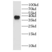 WB analysis of HeLa cells, using GALM antibody (1/600 dilution).