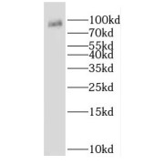 WB analysis of HEK-293 cells, using Gamma adaptin antibody (1/400 dilution).