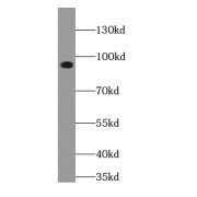 WB analysis of NIH/3T3 cells, using Gamma adducin antibody (1/400 dilution).