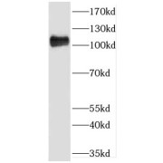 WB analysis of HepG2 cells, using GART antibody (1/500 dilution).