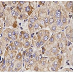 Growth Arrest Specific Protein 2 (GAS2) Antibody