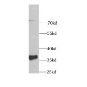 WB analysis of human kidney tissue, using GAS2 antibody (1/1000 dilution).