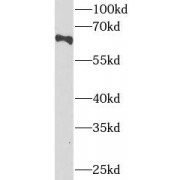 WB analysis of HeLa cells, using GBA antibody (1/1000 dilution).